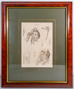 grafica 1800 pastore incisione medicina chirurgia oculistica oftalmica ottica 1