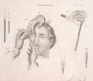 grafica 1800 pastore incisione medicina chirurgia oculistica oftalmica ottica 1