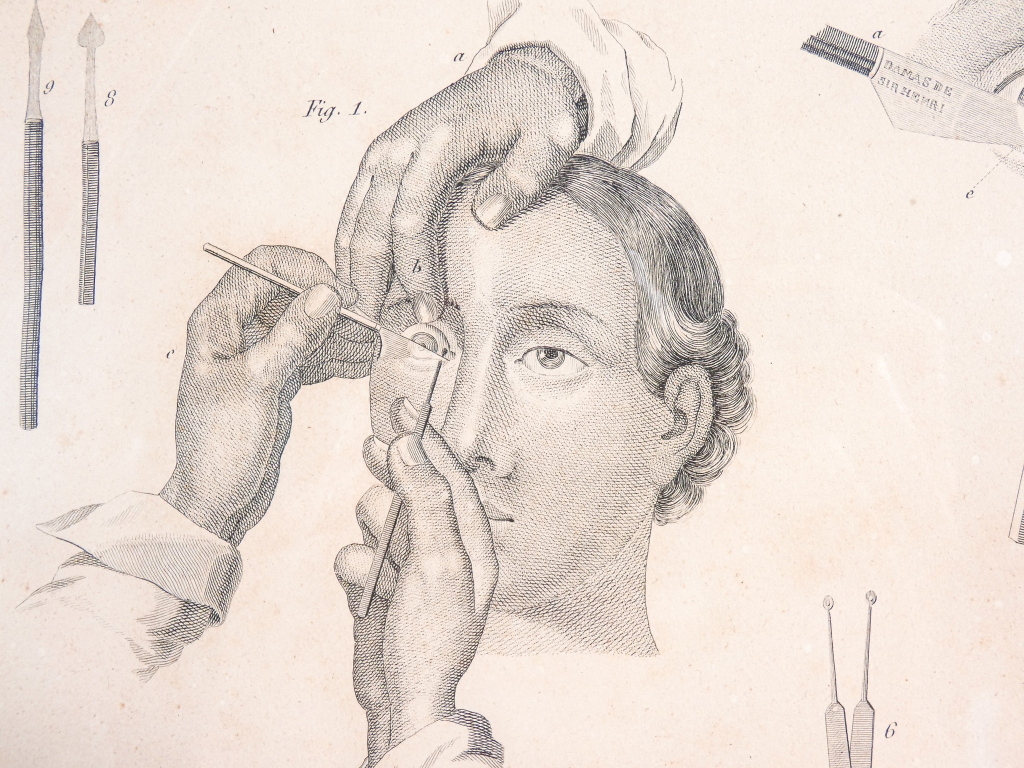 grafica 1800 pastore incisione medicina chirurgia oculistica oftalmica ottica 1