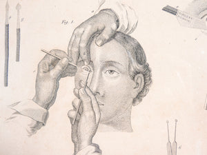 grafica 1800 pastore incisione medicina chirurgia oculistica oftalmica ottica 1