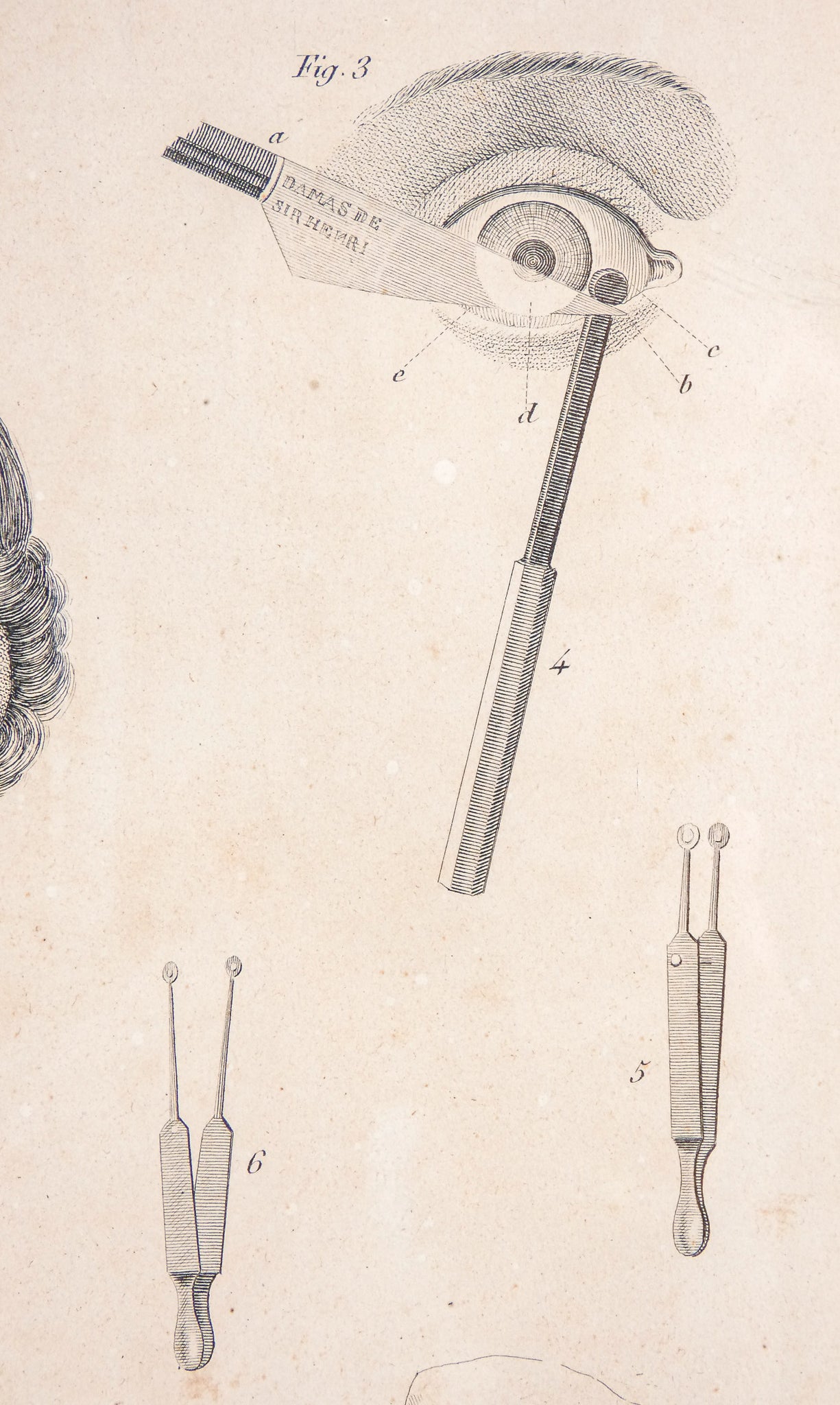 grafica 1800 pastore incisione medicina chirurgia oculistica oftalmica ottica 1