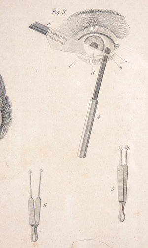 grafica 1800 pastore incisione medicina chirurgia oculistica oftalmica ottica 1