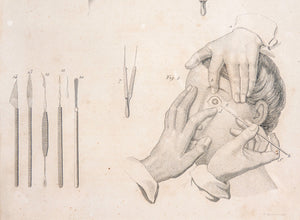 grafica 1800 pastore incisione medicina chirurgia oculistica oftalmica ottica 1