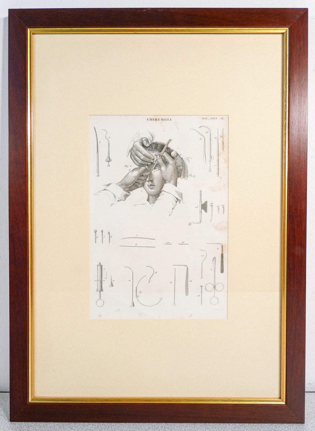grafica 1800 pastore incisione medicina chirurgia oculistica oftalmica ottica 2