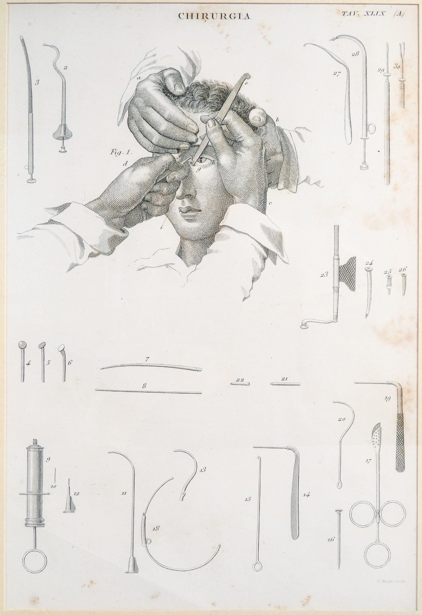 grafica 1800 pastore incisione medicina chirurgia oculistica oftalmica ottica 2