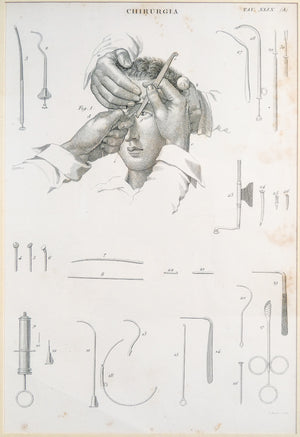 grafica 1800 pastore incisione medicina chirurgia oculistica oftalmica ottica 2