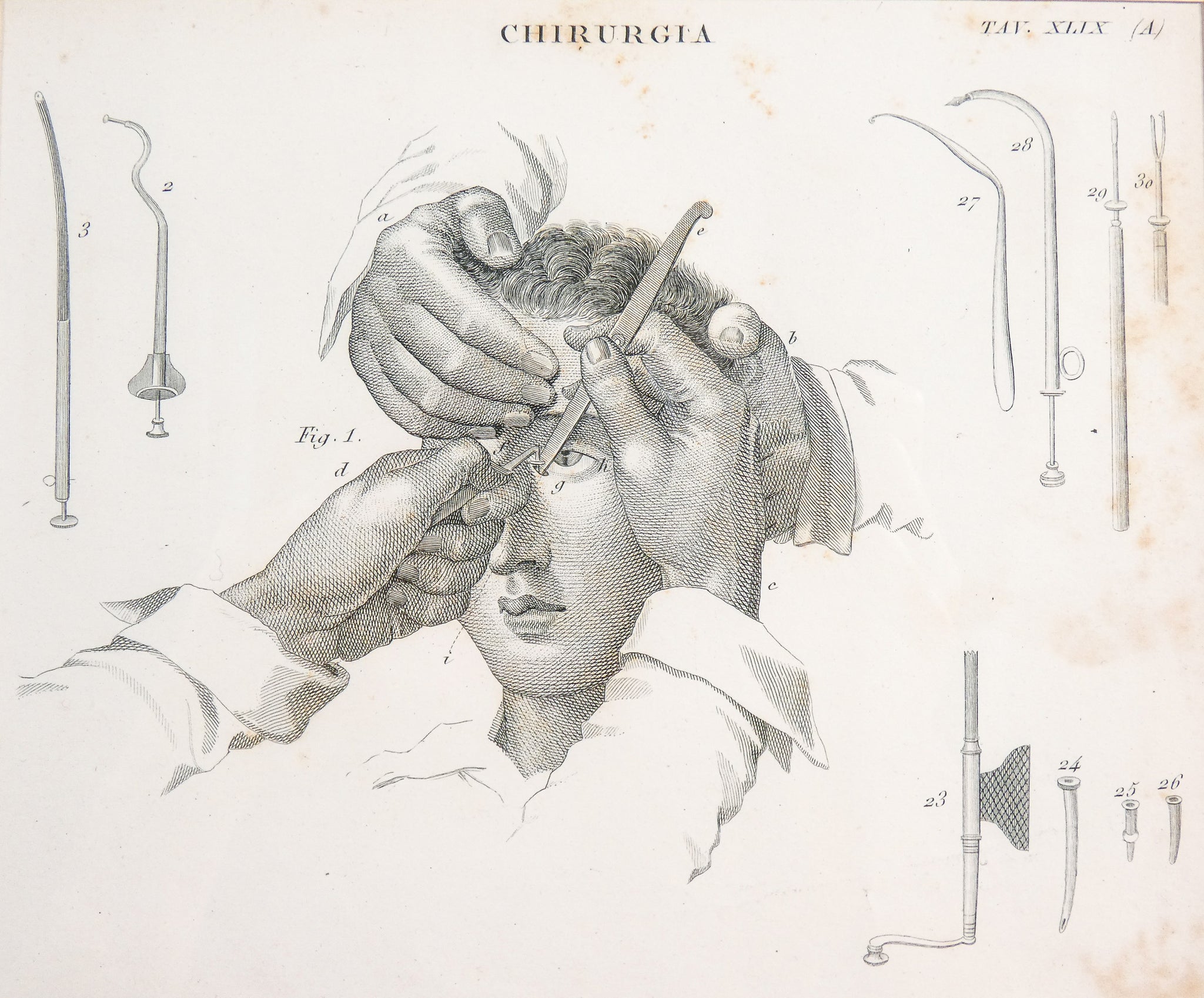grafica 1800 pastore incisione medicina chirurgia oculistica oftalmica ottica 2