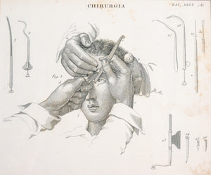grafica 1800 pastore incisione medicina chirurgia oculistica oftalmica ottica 2