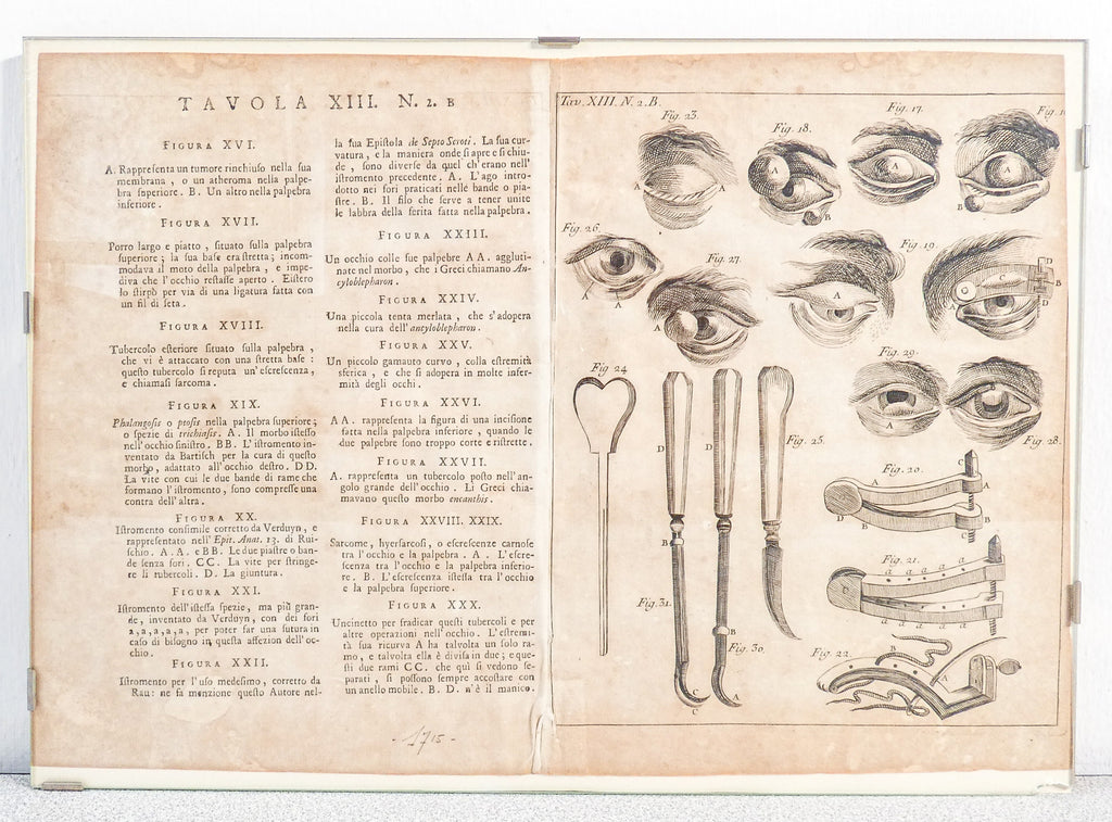stampa grafica 1715 incisione medicina chirurgia oculistica oftalmica ottica