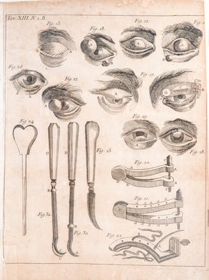stampa grafica 1715 incisione medicina chirurgia oculistica oftalmica ottica