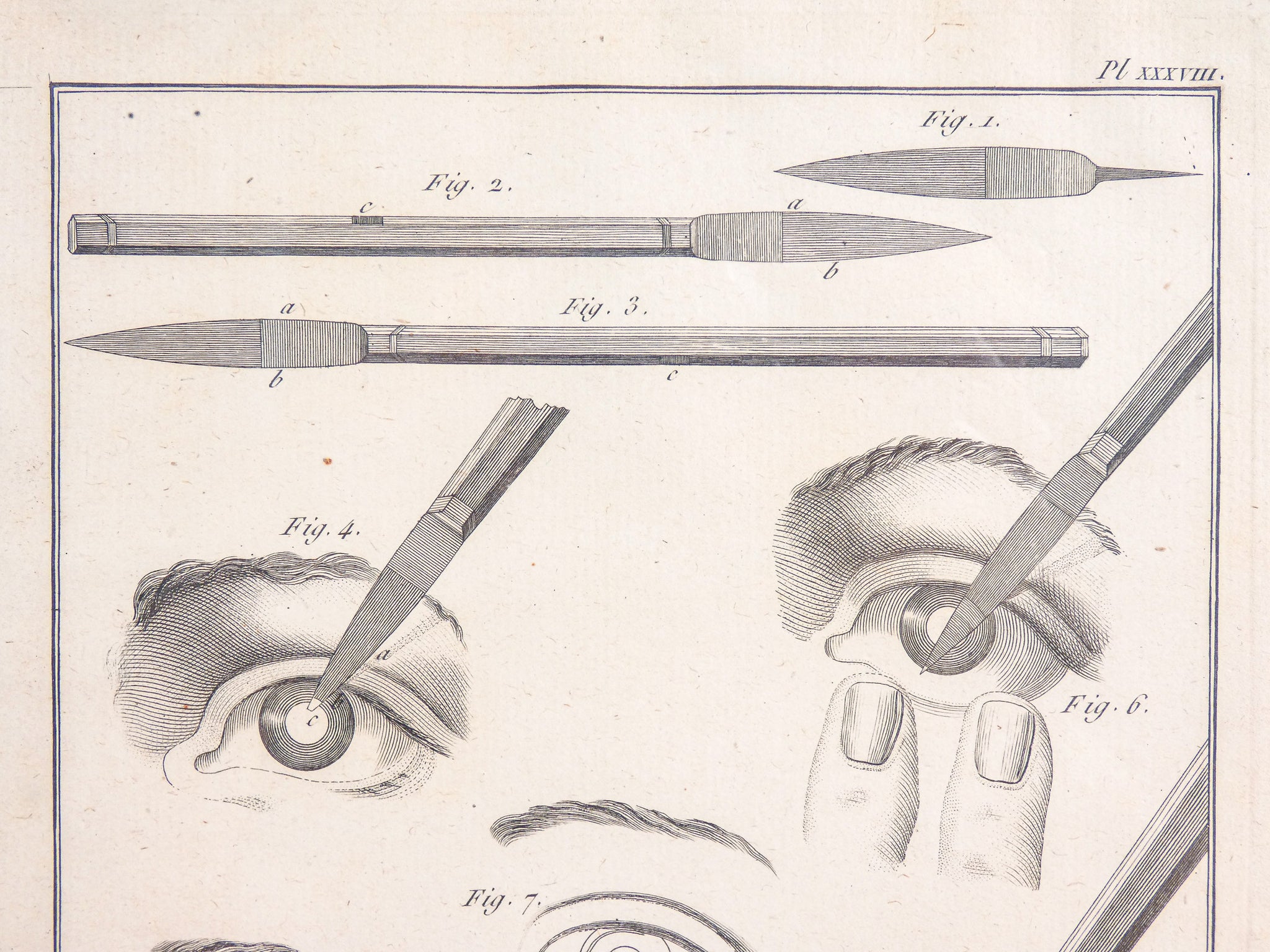 stampa grafica 1790 incisione medicina chirurgia oculistica oftalmica ottica 2