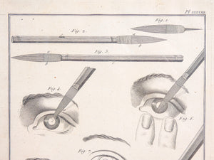 stampa grafica 1790 incisione medicina chirurgia oculistica oftalmica ottica 2
