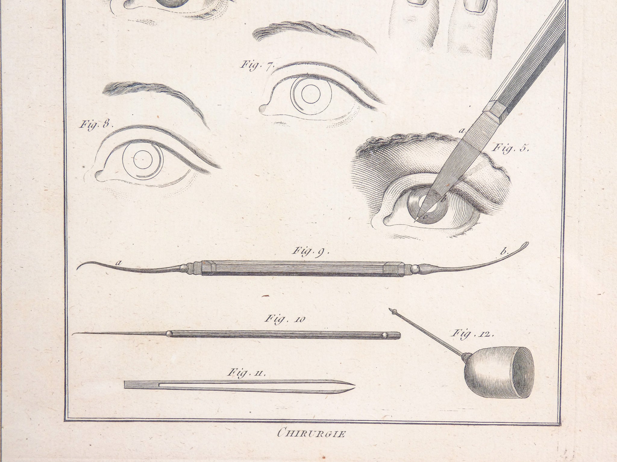 stampa grafica 1790 incisione medicina chirurgia oculistica oftalmica ottica 2