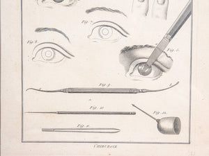 stampa grafica 1790 incisione medicina chirurgia oculistica oftalmica ottica 2