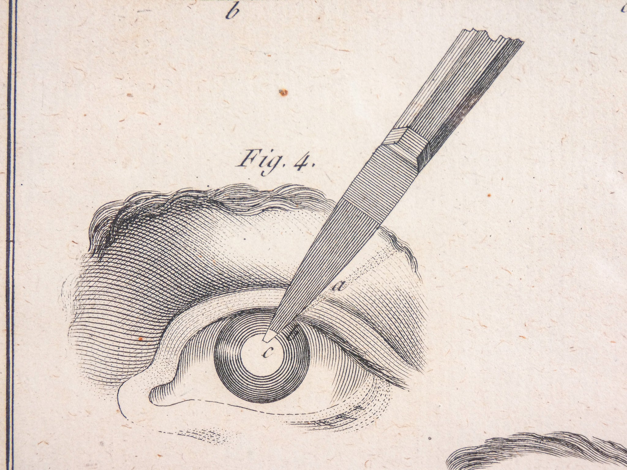 stampa grafica 1790 incisione medicina chirurgia oculistica oftalmica ottica 2