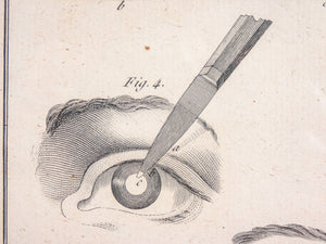 stampa grafica 1790 incisione medicina chirurgia oculistica oftalmica ottica 2