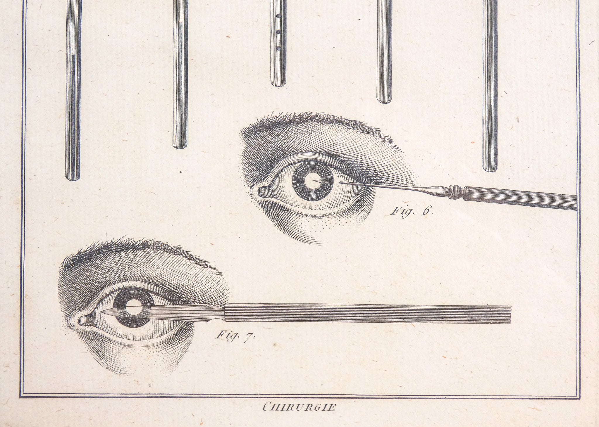 stampa grafica epoca 1790 incisione medicina chirurgia oculistica oftalmica 1