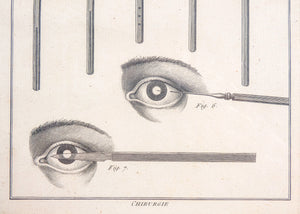 stampa grafica epoca 1790 incisione medicina chirurgia oculistica oftalmica 1